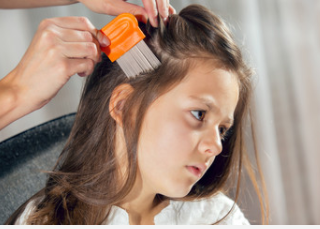 Lice Pediatric Hair Solutions Pic